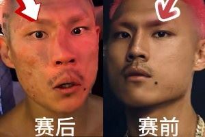 惨遭“整容”!恶鼠遭威姆斯TKO 鼻梁骨被打歪鲜血直流🤕